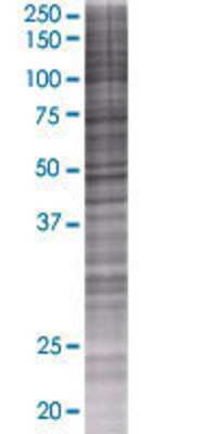 CYP2U1 transfected lysate.