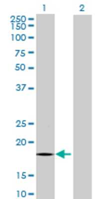 Lane 1: CYP2U1 transfected lysate (18.59 KDa) Lane 2: Non-transfected lysate.