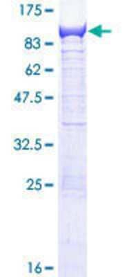 12.5% SDS-PAGE Stained with Coomassie Blue.