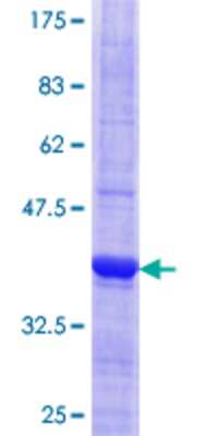 12.5% SDS-PAGE Stained with Coomassie Blue.
