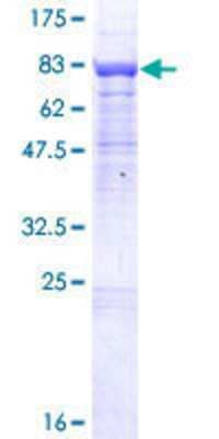 12.5% SDS-PAGE Stained with Coomassie Blue.