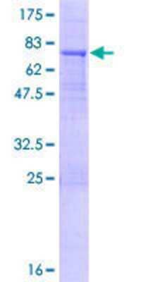 SDS-Page: Recombinant Human KLHL32 Protein [H00114792-P01] - 12.5% SDS-PAGE Stained with Coomassie Blue.