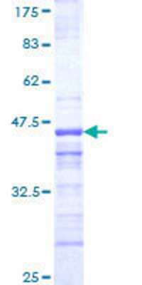 12.5% SDS-PAGE Stained with Coomassie Blue.