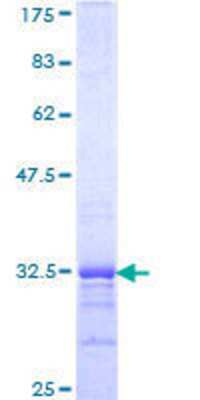 12.5% SDS-PAGE Stained with Coomassie Blue.