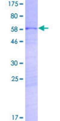 SDS-Page: Recombinant Human CROCCL2 Protein [H00114819-P01] - 12.5% SDS-PAGE Stained with Coomassie Blue.