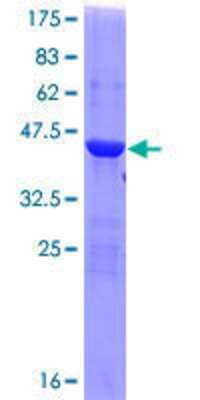 12.5% SDS-PAGE Stained with Coomassie Blue.