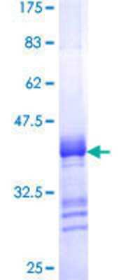 12.5% SDS-PAGE Stained with Coomassie Blue.