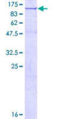 12.5% SDS-PAGE Stained with Coomassie Blue.