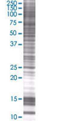 C1QTNF5 transfected lysate.