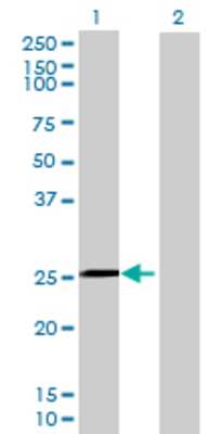 Lane 1: C1QTNF5 transfected lysate (26.84 KDa) Lane 2: Non-transfected lysate.