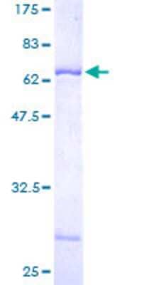 12.5% SDS-PAGE Stained with Coomassie Blue.