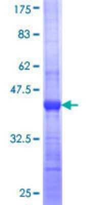 12.5% SDS-PAGE Stained with Coomassie Blue.