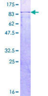 12.5% SDS-PAGE Stained with Coomassie Blue.