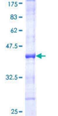 12.5% SDS-PAGE Stained with Coomassie Blue.