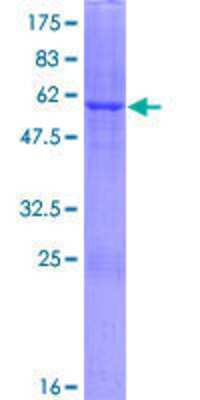Other Recombinant Human DHRS1 GST (N-Term) Protein