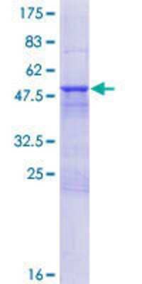 Recombinant Human TXNL6 Protein [H00115861-P01] - 12.5% SDS-PAGE Stained with Coomassie Blue.