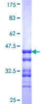 12.5% SDS-PAGE Stained with Coomassie Blue.