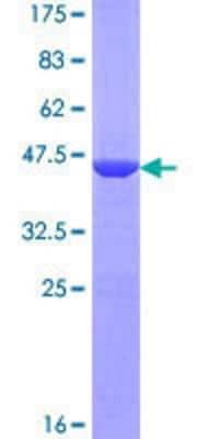 12.5% SDS-PAGE Stained with Coomassie Blue.