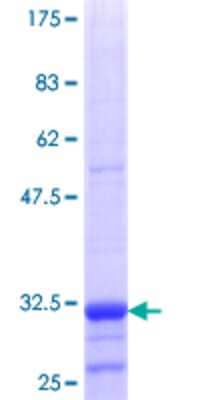 Other Recombinant Human SLC22A12 GST (N-Term) Protein