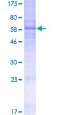 12.5% SDS-PAGE Stained with Coomassie Blue.