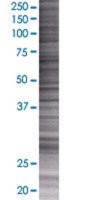 OLIG1 transfected lysate.