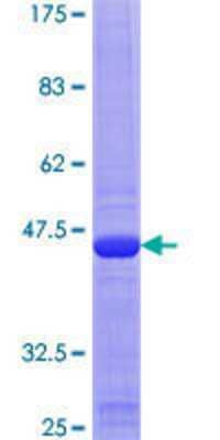 12.5% SDS-PAGE Stained with Coomassie Blue.