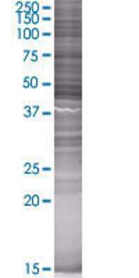 CENTG2 transfected lysate.