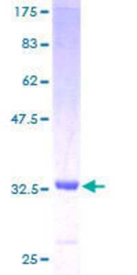 12.5% SDS-PAGE Stained with Coomassie Blue.