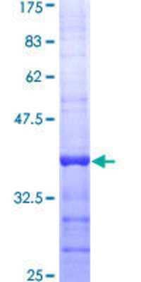 12.5% SDS-PAGE Stained with Coomassie Blue.