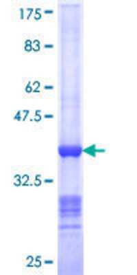 Other Recombinant Human NEDD1 GST (N-Term) Protein