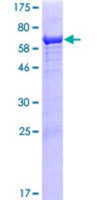 12.5% SDS-PAGE Stained with Coomassie Blue.