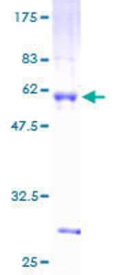 12.5% SDS-PAGE Stained with Coomassie Blue.