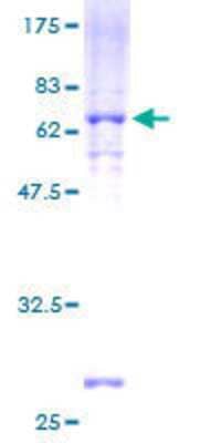 12.5% SDS-PAGE Stained with Coomassie Blue.