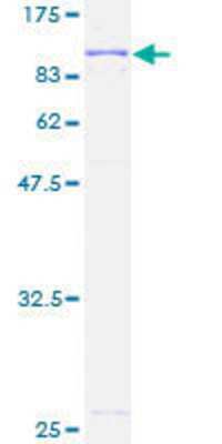 12.5% SDS-PAGE Stained with Coomassie Blue.