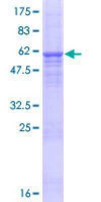 12.5% SDS-PAGE Stained with Coomassie Blue.