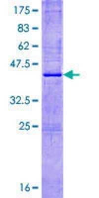 Recombinant Human RNASE8 Protein [H00122665-P01] - 12.5% SDS-PAGE Stained with Coomassie Blue.