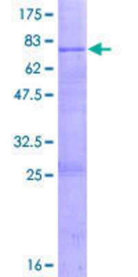 12.5% SDS-PAGE Stained with Coomassie Blue.