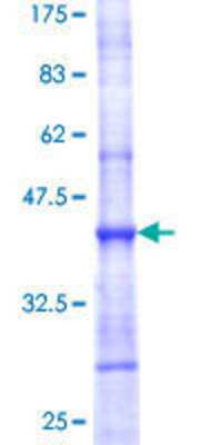12.5% SDS-PAGE Stained with Coomassie Blue.