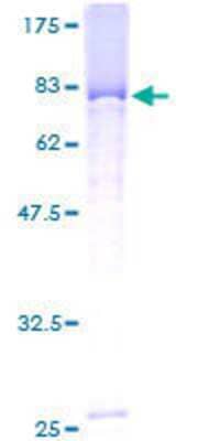 12.5% SDS-PAGE Stained with Coomassie Blue.