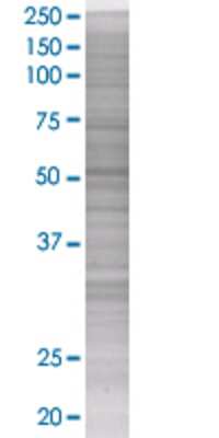 SOCS4 transfected lysate.