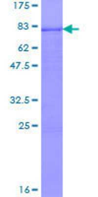 12.5% SDS-PAGE Stained with Coomassie Blue.