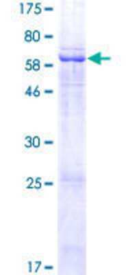 12.5% SDS-PAGE Stained with Coomassie Blue.