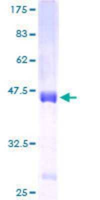 12.5% SDS-PAGE Stained with Coomassie Blue.