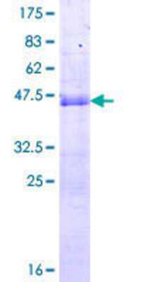 12.5% SDS-PAGE Stained with Coomassie Blue.