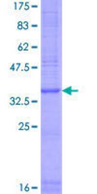 12.5% SDS-PAGE Stained with Coomassie Blue.