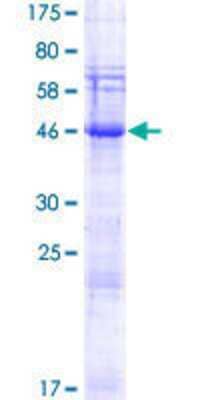 SDS-PAGE Recombinant Human SPACA3 GST (N-Term) Protein