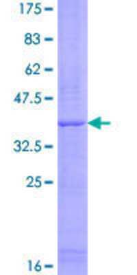 12.5% SDS-PAGE Stained with Coomassie Blue.