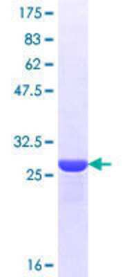 12.5% SDS-PAGE Stained with Coomassie Blue.