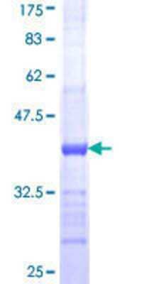 12.5% SDS-PAGE Stained with Coomassie Blue.