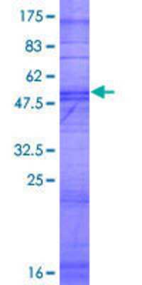 12.5% SDS-PAGE Stained with Coomassie Blue.